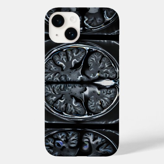 Coques Case-Mate iPhone Analyse cérébrale par IRM (Verso)