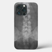 Coques Case-Mate iPhone Art numérique X-Ray (Verso)