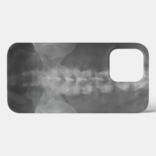 Coques Case-Mate iPhone Art numérique X-Ray (Verso (horizontal))