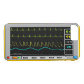 Coques Case-Mate iPhone Cas d'iPhone et d'électronique de moniteur (Dos (Horizontal))