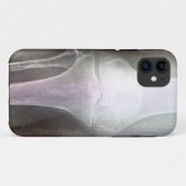 COQUES Case-Mate iPhone COUVERTURE DU RAYON X IPHONE DE GENOU (Dos (Horizontal))