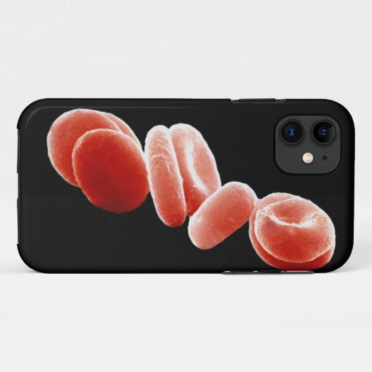 Coques Case-Mate iPhone Globules rouges (Dos (Horizontal))
