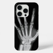 Coques Case-Mate iPhone Housse Skeleton iPhone 15 pro (Verso)