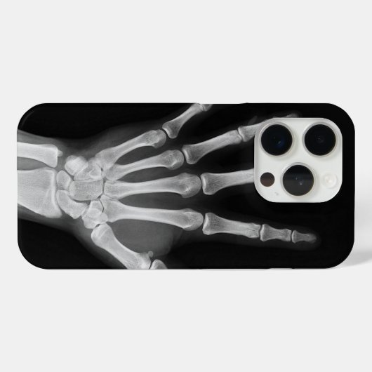 Coques Case-Mate iPhone Housse Skeleton iPhone 15 pro (Verso (horizontal))