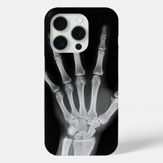 Coques Case-Mate iPhone Housse Skeleton pour iPhone 15 pro (Verso)