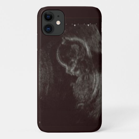 Coques Case-Mate iPhone Photo de votre bébé Ultrasound (Dos)