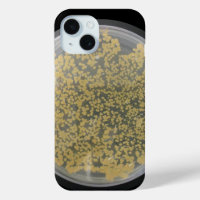 Plaque de culture de bactéries recouverte de colon