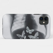 Coques Case-Mate iPhone Rayon X des papillons dans l'estomac (Dos (Horizontal))