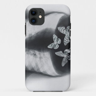 Coque Case-Mate Pour iPhone Rayon X des papillons dans l'estomac