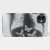 Coques Case-Mate iPhone Rayon X des papillons dans l'estomac (Dos (Horizontal))