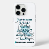 Coques Case-Mate iPhone "Regarde" Sain/Papillon...Graves' (Verso)