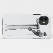 Coques Case-Mate iPhone Tree Surgeon Arborist Forester (Dos (Horizontal))