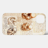 Coques Case-Mate iPhone Vues d'un foetus dans l'utérus, Ob-Gyn Médicale (Verso (horizontal))