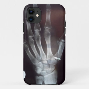 Coque Case-Mate Pour iPhone X cas de téléphone de main de rayon