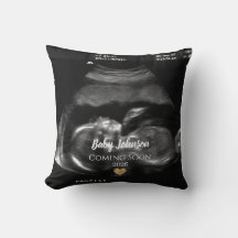 Bébé Bientôt Ultrasound Gold coeur