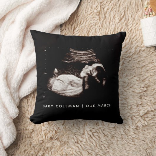 Coussin Faire-part de grossesse Sonogramme photo (Couverture)