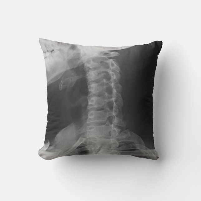 Coussin X-Rayed 2 (Original) (Recto)