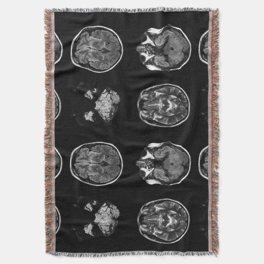 Couverture Analyse IRM du cerveau (devant Vertical)