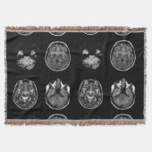 Couverture Analyse IRM du cerveau (Devant)