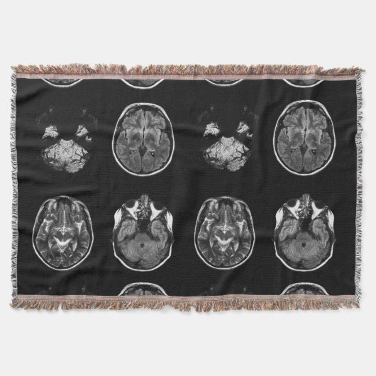 Couverture Analyse IRM du cerveau (Devant)