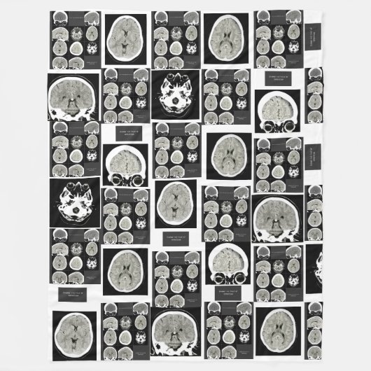 Couverture Polaire Analyse CT_ceci est dépression_CTFOD (Devant)