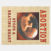 COUVERTURE POLAIRE L'AVORTEMENT ARRÊTE UN COEUR BATTANT (Devant (Horizontal))