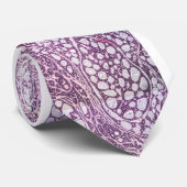 Cravate carcinome kystique adénoïde glande lacrique (Roulé)