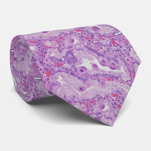 Cravate CMV Endocervicitis (Roulé)