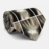 Cravate de rayon X de carpiens (Roulé)