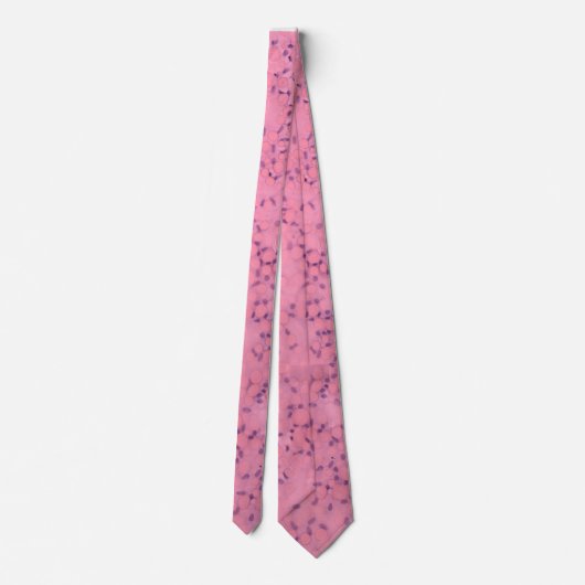 Cravate dystrophie Necktie Fuchs (Dos)