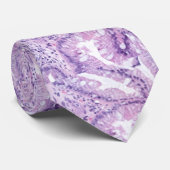 Cravate L'oesophage de Barrett - métaplasie intestinale (Roulé)