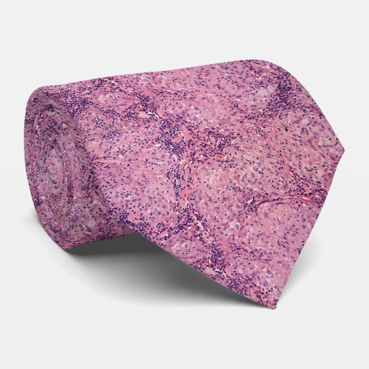 Cravate Sarcoïdose (Roulé)