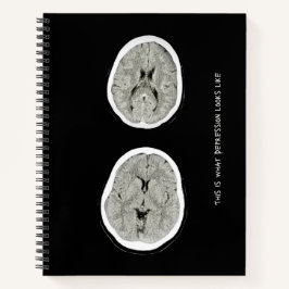 CT Scan_CTFOD_ Zo ziet een depressie eruit Notitieboek