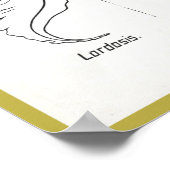 Curven van het Poster van de wervelkolom (Hoek)