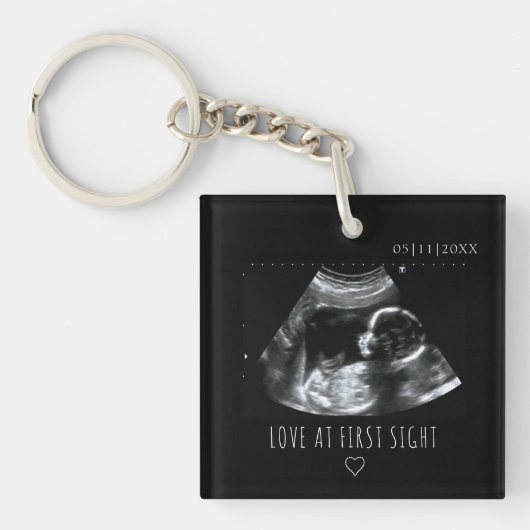 Cute Ultrasound Afbeelding Gift Sonogram Sleutelhanger (Voorkant)