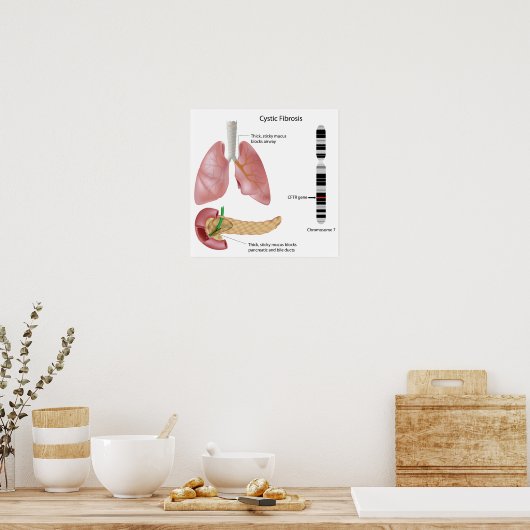 Cystic fibrosis Poster (Cuisine)