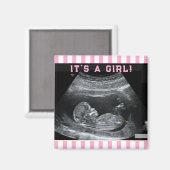 De eerste foto van de baby magneet (Voorkant / Achterkant)