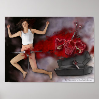 De hysterectomie poster