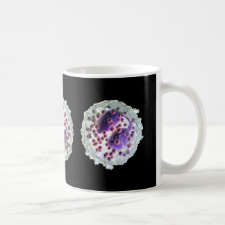De Mok van de koffie - Eosinophilia