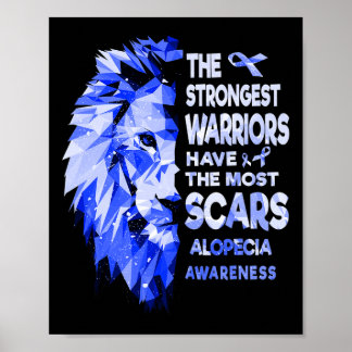 De sterkste Alopecia krijgers hebben het meeste li Poster