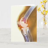 De vervanging van de knie. Gekleurde Röntgenstraal Kaart (Gele Bloem)