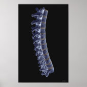 De wervelkolom 3 poster (Voorkant)