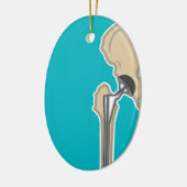 Décoration En Céramique Remplacement d'articulation de la hanche (Gauche)