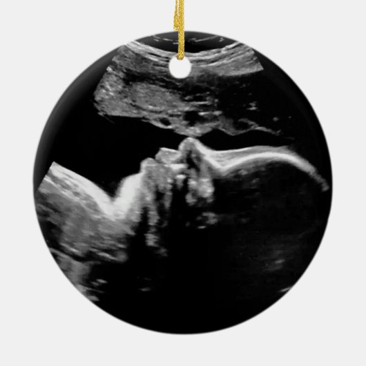 Décoration En Céramique Ultrasound personnalisé 1er Noël (Dos)