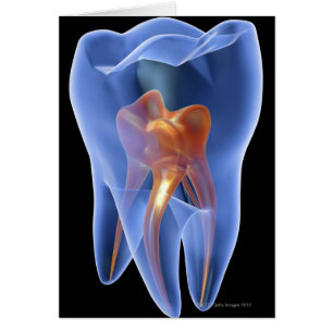 Dent, coupe transparente d'une molaire