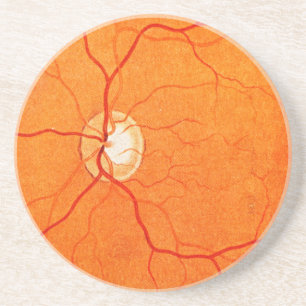 Dessous De Verre En Grès Ophtalmologie Optométrie Eye Médicale Exposition