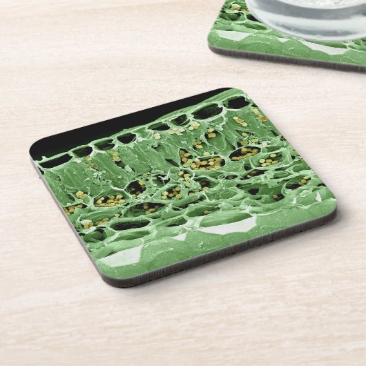 Dessous-de-verre Section transversale de feuille (Côté gauche)