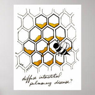 Diffuse Interstitiële longziekte Poster