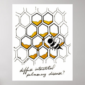 Diffuse Interstitiële longziekte Poster