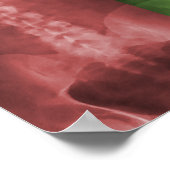 Digitaal Poster voor röntgenstralen (Hoek)